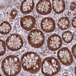 Galectin-9 Antibody, Novus Biologicals 25 &mu;L, Unlabeled:Antibodies,
